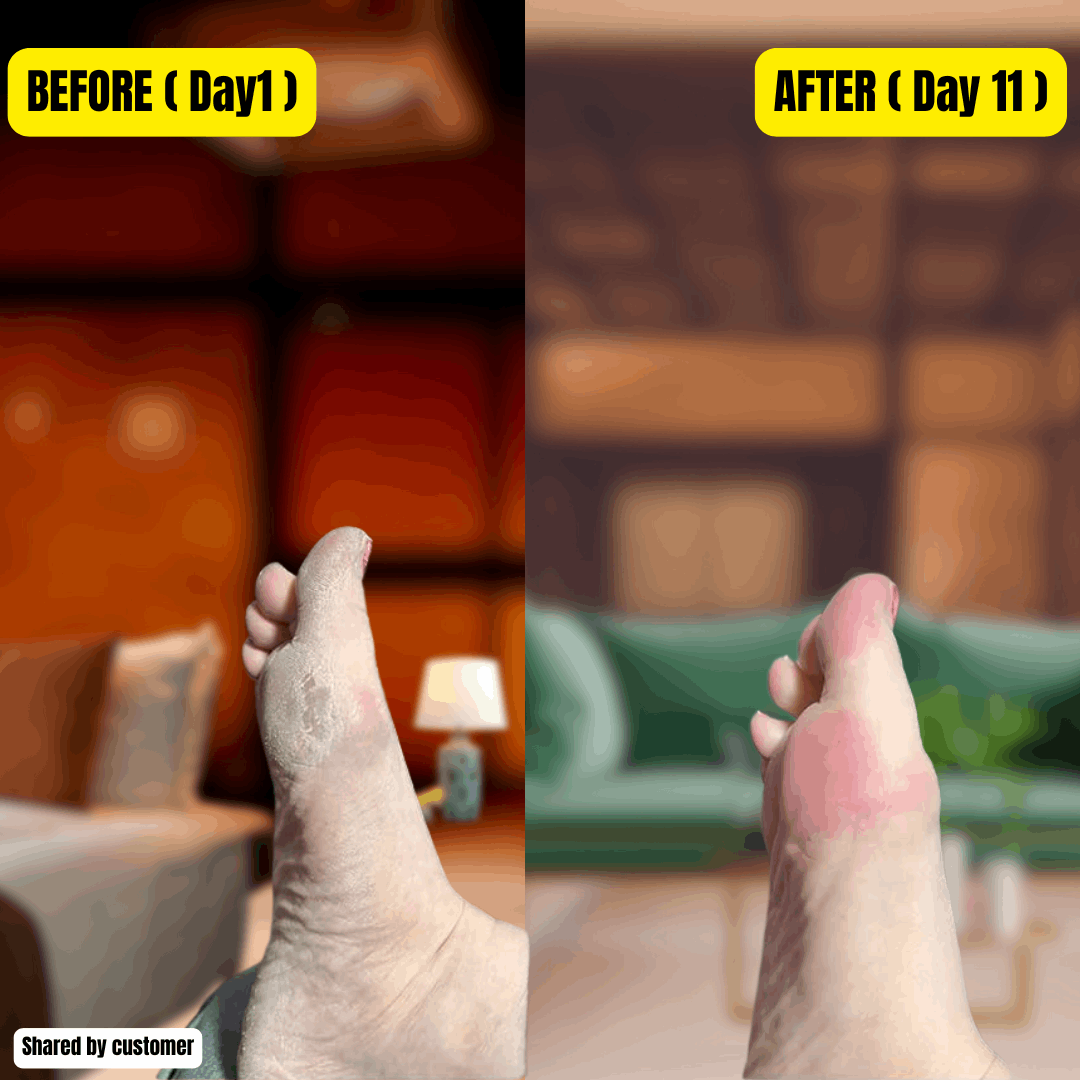 FLAWLESS Pedicure Callus Remover – Cordless & Rechargeable