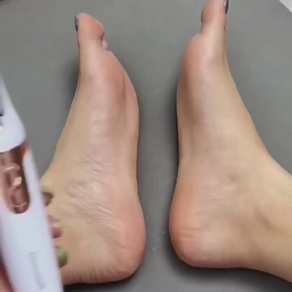 FLAWLESS Pedicure Callus Remover – Cordless & Rechargeable